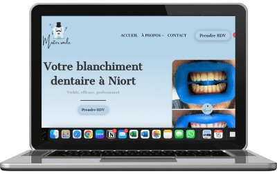 Création site web cabinet blanchiment dentaire